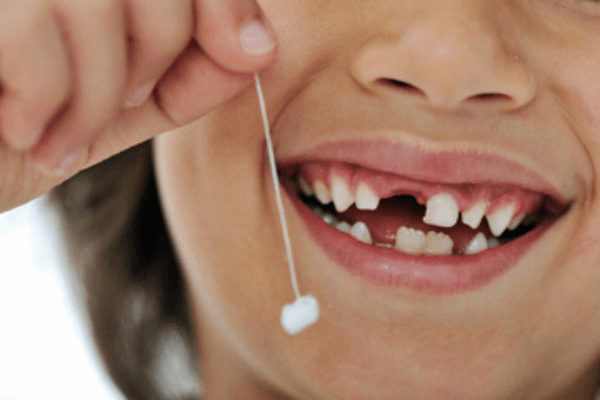 Cách nhổ răng sữa bằng chỉ có an toàn không?