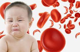 Trẻ sơ sinh thiếu máu do thiếu sắt
