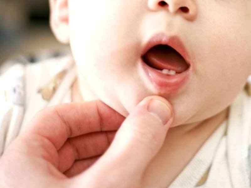 Các dấu hiệu và triệu chứng mọc răng ở trẻ