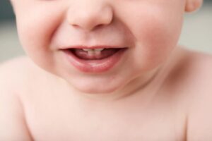 Làm sao để biết trẻ mọc thiếu răng sữa hay không?