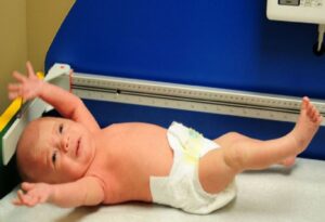 Tăng trương lực cơ ở trẻ sơ sinh