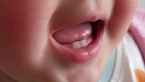 Giúp bé giảm đau, giảm sốt khi mọc răng