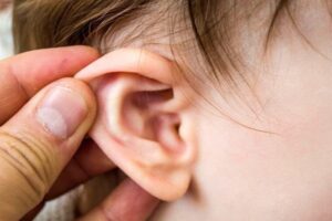Chẩn đoán và điều trị viêm tai xẹp nhĩ ở trẻ em