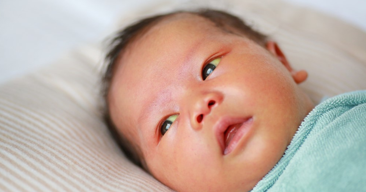 Có xét nghiệm nào chẩn đoán vàng da ở trẻ sơ sinh không?