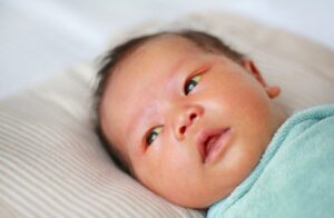 Chỉ số bilirubin vàng da ở trẻ sơ sinh