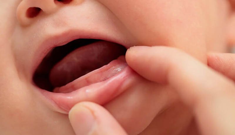 Có cách nào giúp trẻ nhanh mọc răng không?