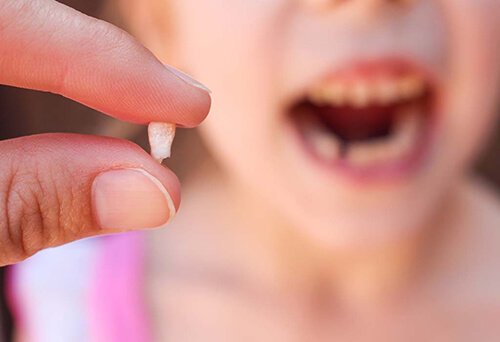 Răng hàm trẻ em có thay không?