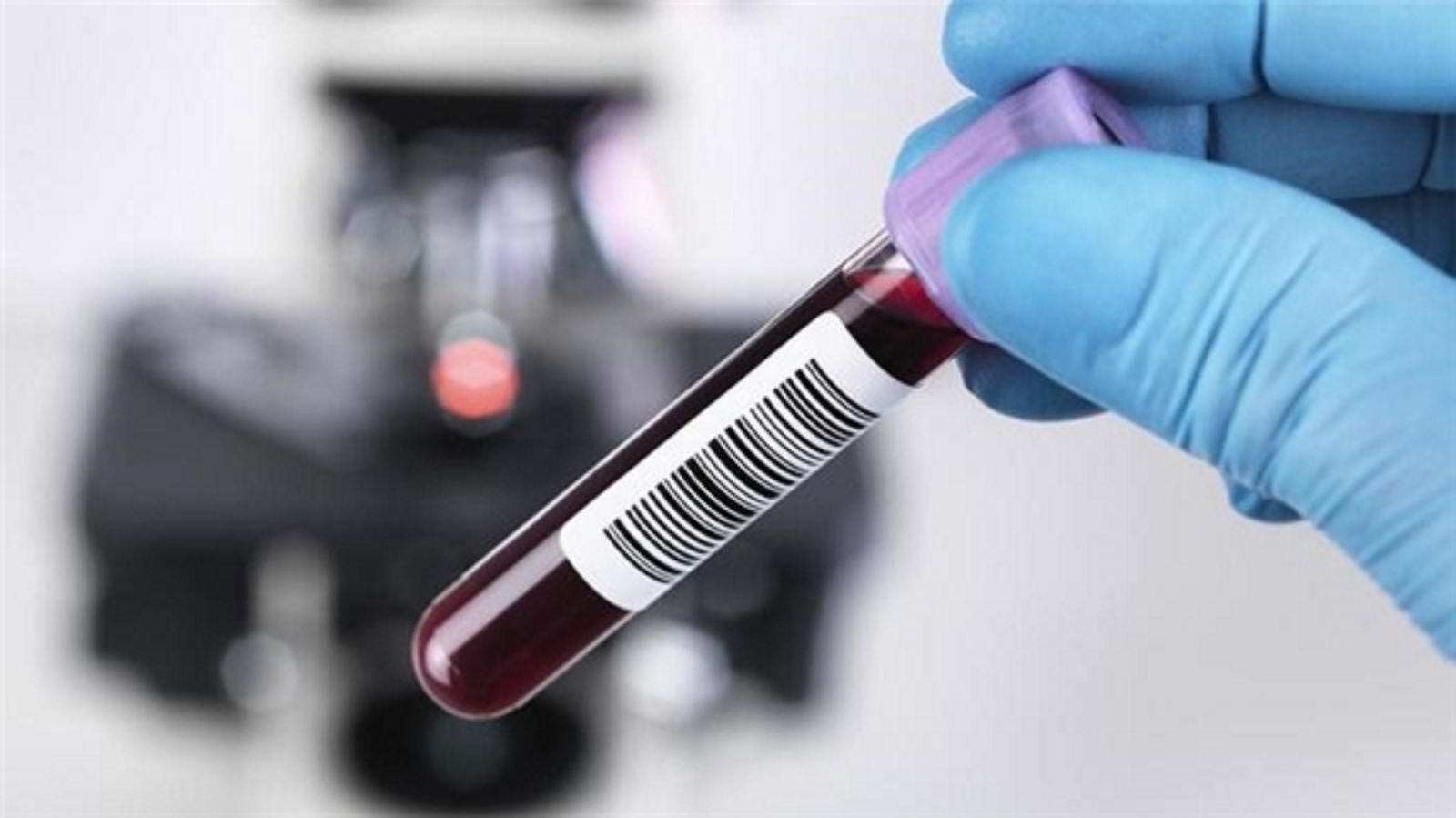 Bị viêm gan B kết quả xét nghiệm hồng cầu tăng, RBC 5.68 T/ L, HGB 160g/L thì nên đi khám và làm các xét nghiệm gì để kiểm tra?