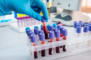 Kết quả xét nghiệm virus viêm gan âm tính có ý nghĩa gì?