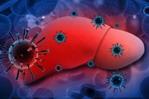 Nồng độ virus viêm gan B mãn tính như thế nào phải điều trị?
