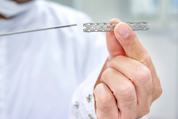 Cần làm gì sau khi đặt stent đường mật bị tuột ra ngoài?