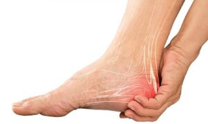 Nguyên nhân đau gót chân sau khi vận động là gì?