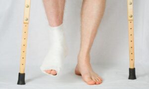 Bài tập phục hồi cho người gãy ngón chân?