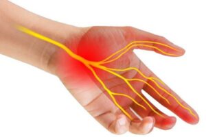 Có cách nào điều trị tổn thương dây thần kinh trụ dưới cổ tay trái làm tê nhức ngón tay út không?