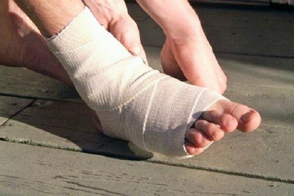 Triệu chứng đau sau gãy mu bàn chân 6 tuần có sao không?