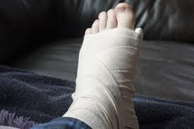 Điều trị sau tháo bột xương bàn chân như thế nào?