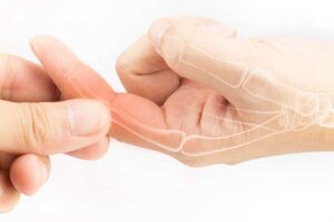 Đau nhức ngón tay sau mổ gắn vít inox gãy ngón tay có sao không?