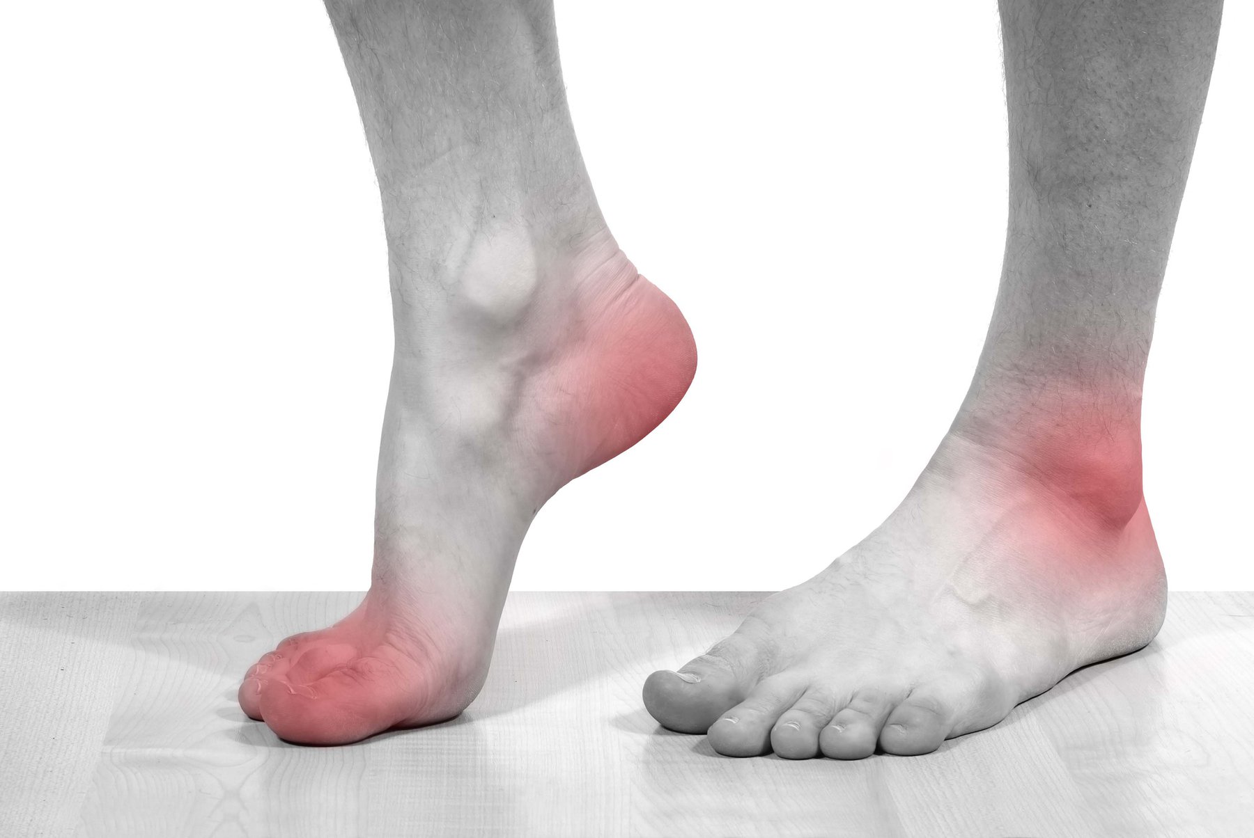 Đau gót chân sau mổ gãy xương cẳng chân có sao không?