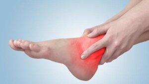Vết thương hở ở mu bàn chân lâu lành sau ngã rạn xương có sao không?
