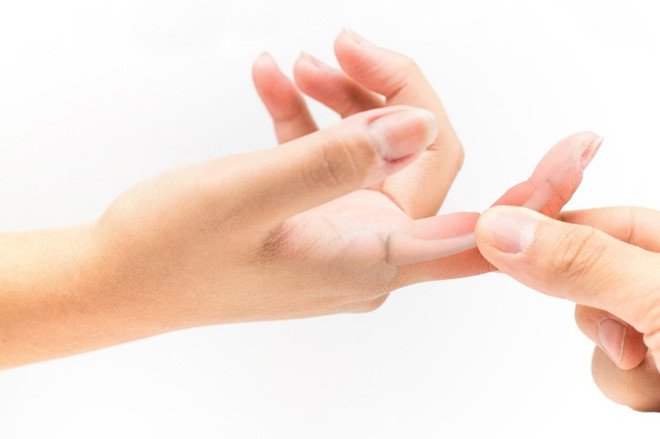 Cứng khớp ngón tay trỏ chữa trị được không?
