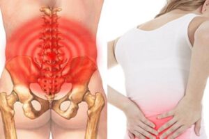 Đau nhẹ vùng xương tiếp giáp mông và lưng bên phải là bị bệnh gì?