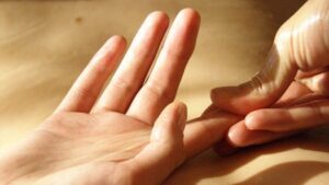Nữ giới mất cảm giác ở tay sau phẫu thuật nối gân ngón tay có ảnh hưởng gì?