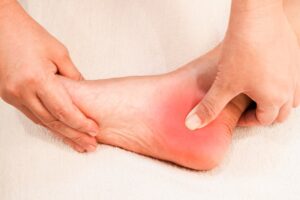 Gót chân và mũi chân mất lực là dấu hiệu bệnh lý gì?