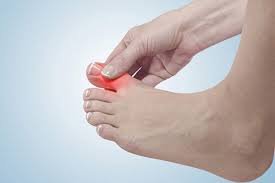 Sưng tấy, đau nhức khớp ngón chân là bệnh gì?