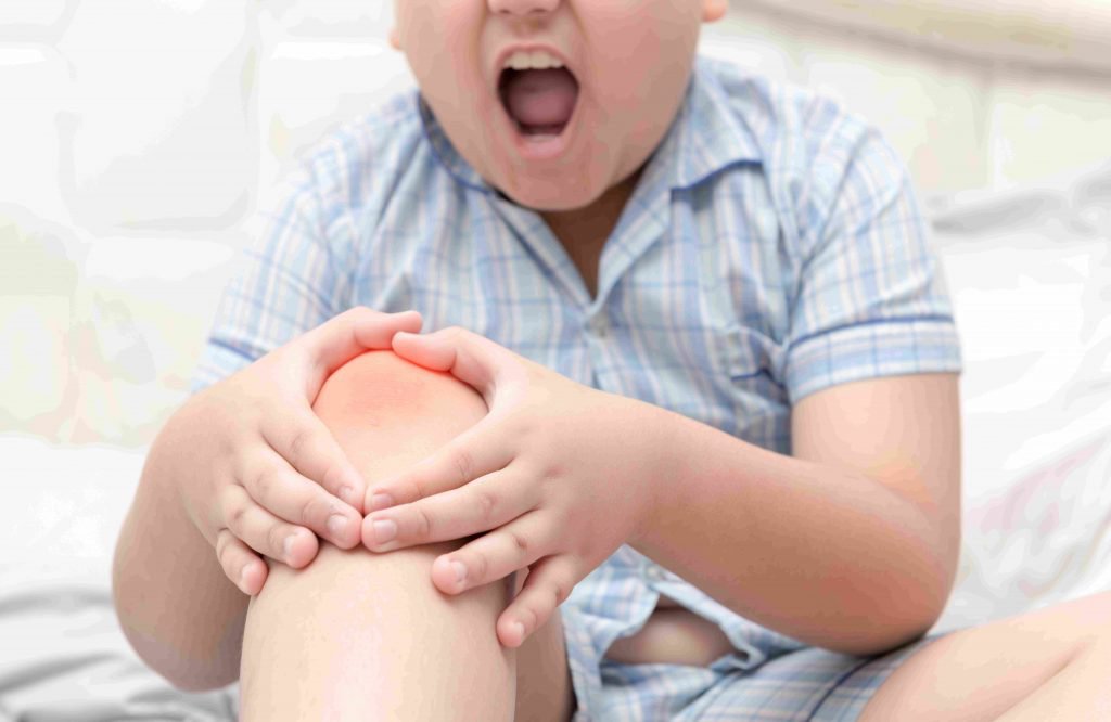 Trẻ 10 tuổi sau gãy 1/3 xương bánh chè hiện khớp gối hay đọng dịch nên điều trị thế nào?