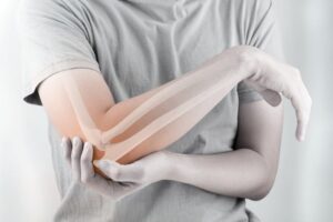 Gãy 1/3 xương cánh tay trên đã phẫu thuật nẹp vít được 3 tuần nhưng co duỗi nghe đau rõ thì có ổn không?