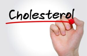 5 sự thật bất ngờ về cholesterol