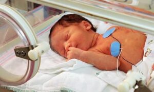 Các phương pháp hỗ trợ cho trẻ sơ sinh suy hô hấp